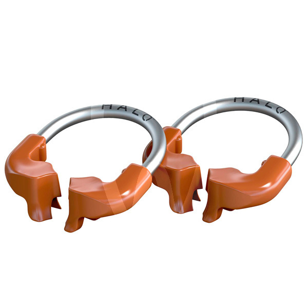 Halo universal ring for sectional matrices (2 pcs) restoration ultradent