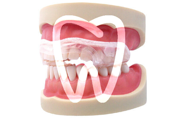Aqualizer functional appliances dentrade